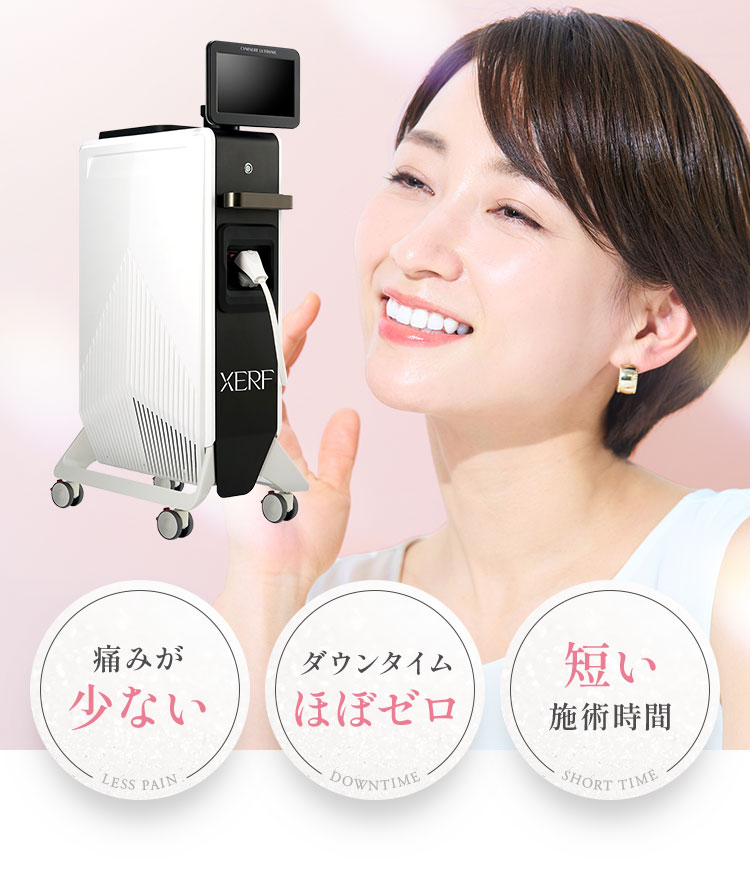 ダウンタイムほぼゼロ